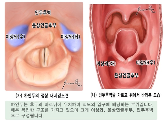 윤상인두근육